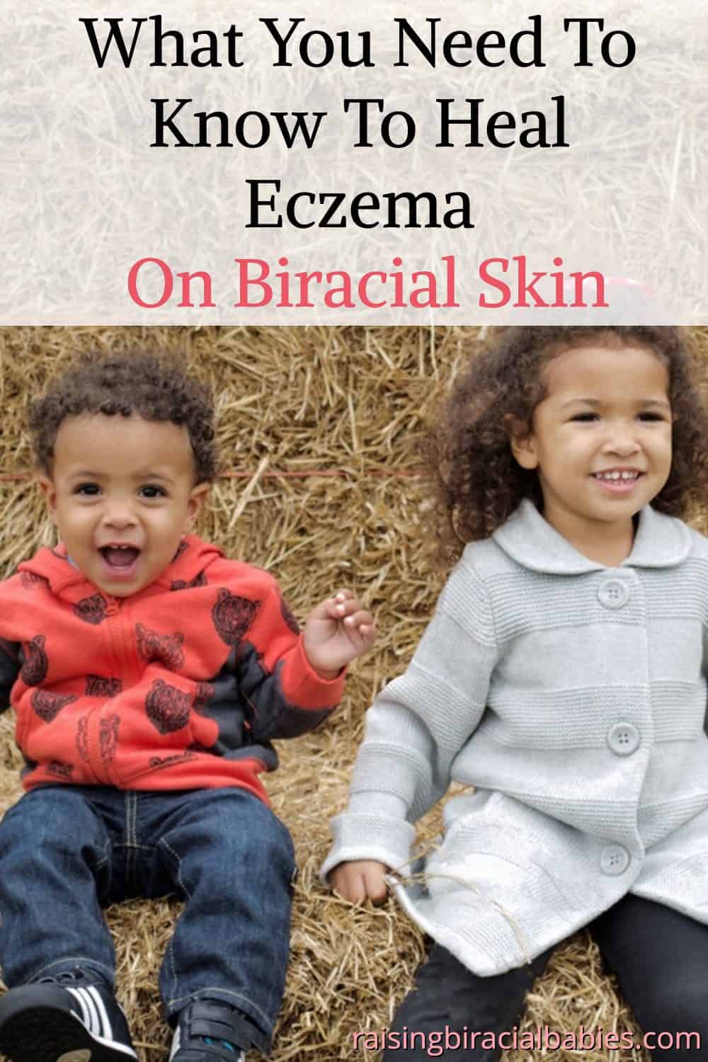 How to Help Heal Eczema on Biracial Skin (In 6 Steps)